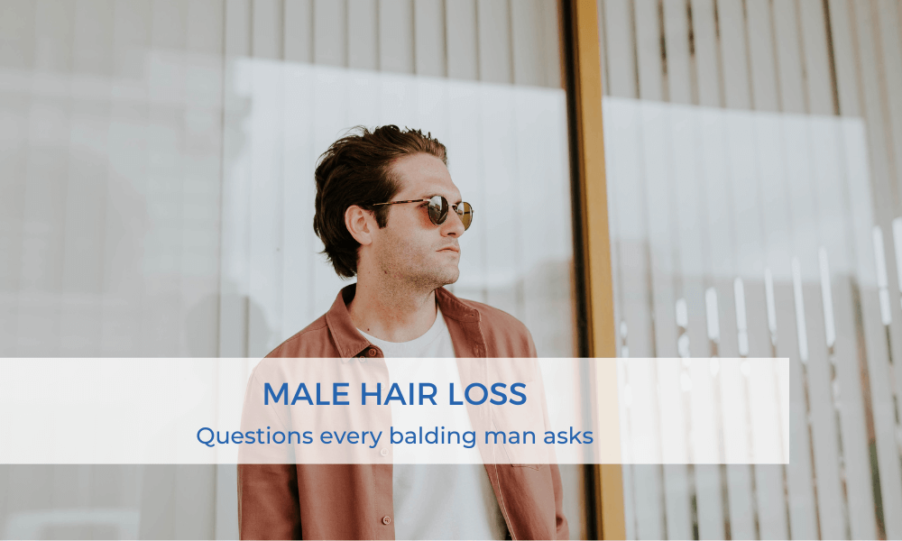 Male hair loss