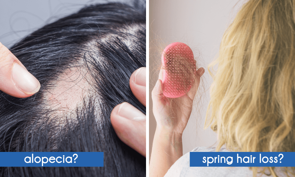 Against spring hair loss